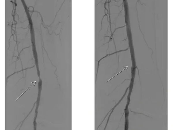 1759440807_rs_w_600_h_451