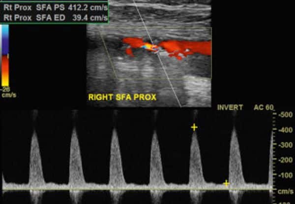 1759440830_rs_w_600_cg_true